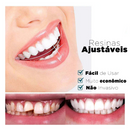 Facetas Dentárias Naturais Removíveis (Superior e Inferior) - SmileFit - Vinych