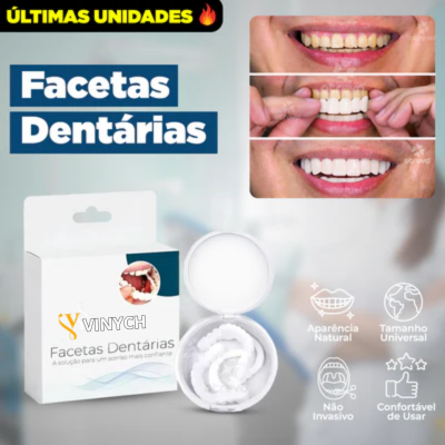 Facetas Dentárias Naturais Removíveis (Superior e Inferior) - SmileFit - Vinych