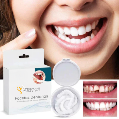 Facetas Dentárias Naturais Removíveis (Superior e Inferior) - SmileFit - Vinych