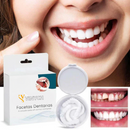 Facetas Dentárias Naturais Removíveis (Superior e Inferior) - SmileFit - Vinych